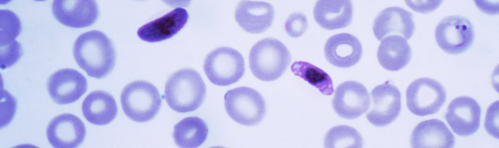 Malaria in West Africa